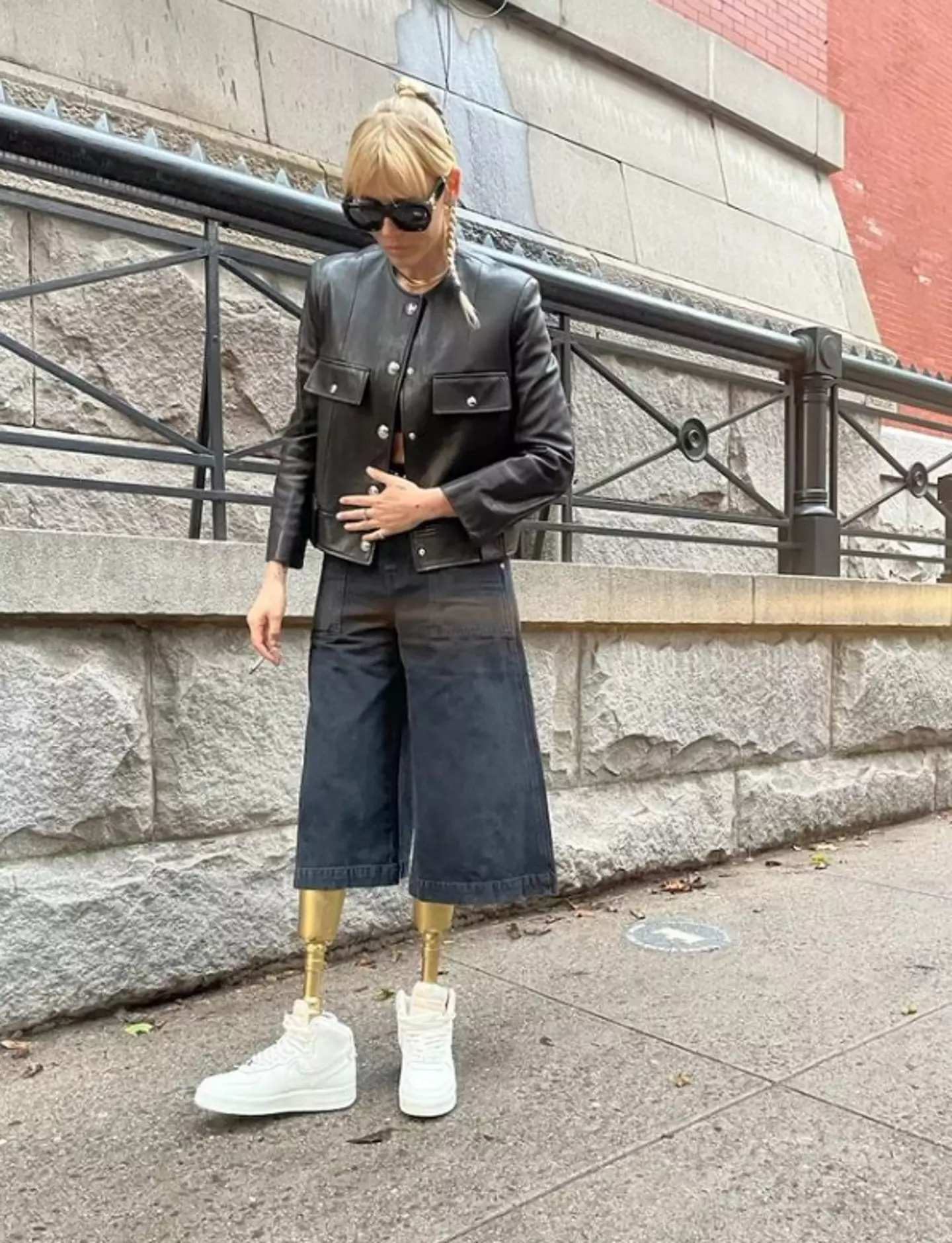 The American woman has since had both of her legs amputated. (Instagram/@theimpossiblemuse)