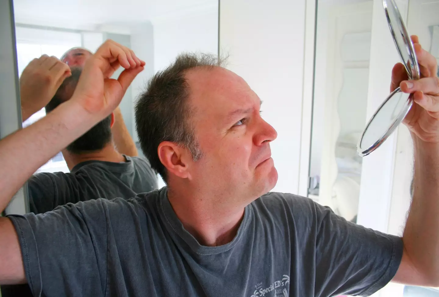 The discovery of a new gene could potentially lead to a cure for baldness.