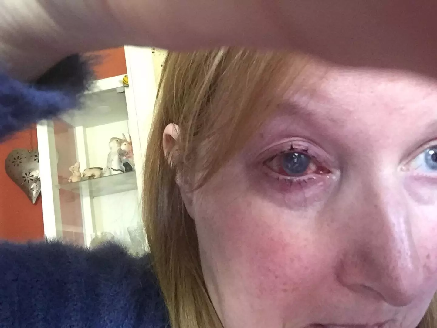 Marie Mason's eye was seriously sore, but she initially didn't know why.