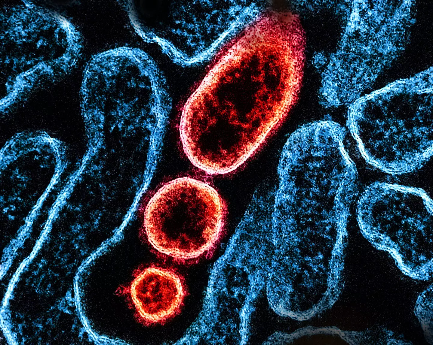 Nipah virus, seen in red, has no cure or vaccine (NIH-NIAID/Image Point FR/BSIP/Universal Images Group via Getty Images)