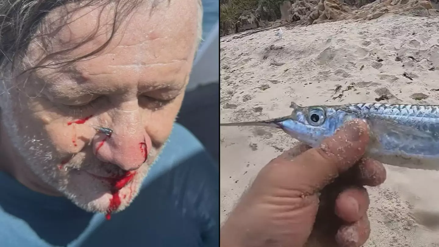 Aussie impaled by actual fish during freak surfing accident