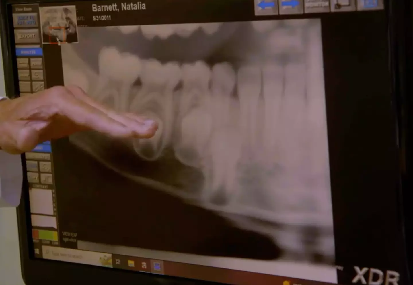 A dentist who x-rayed Natalia Grace said he 'indisputable' evidence showing how old she is.
