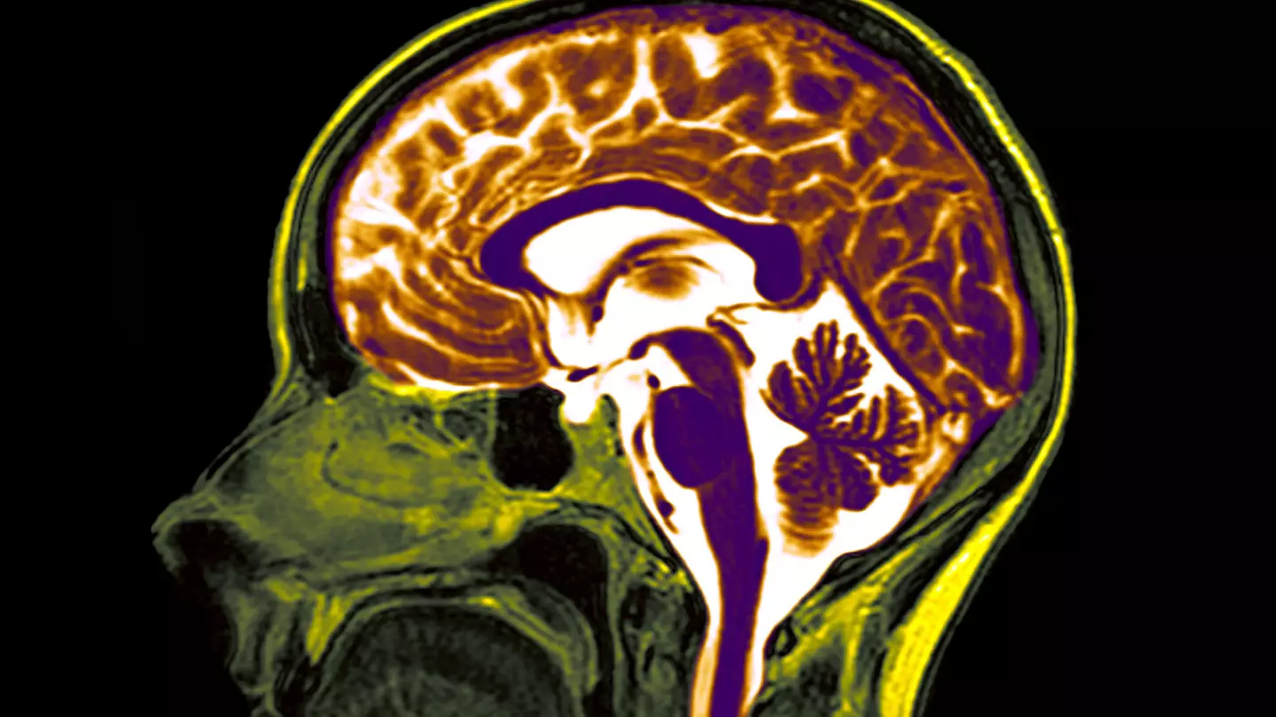 BSIP/Universal Images Group via Getty Images