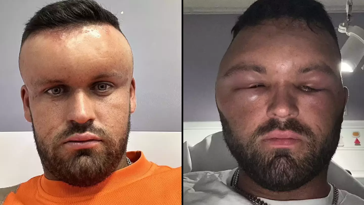 Man left looking like ’Megamind' after having huge reaction so bad his girlfriend ‘couldn’t look at him’
