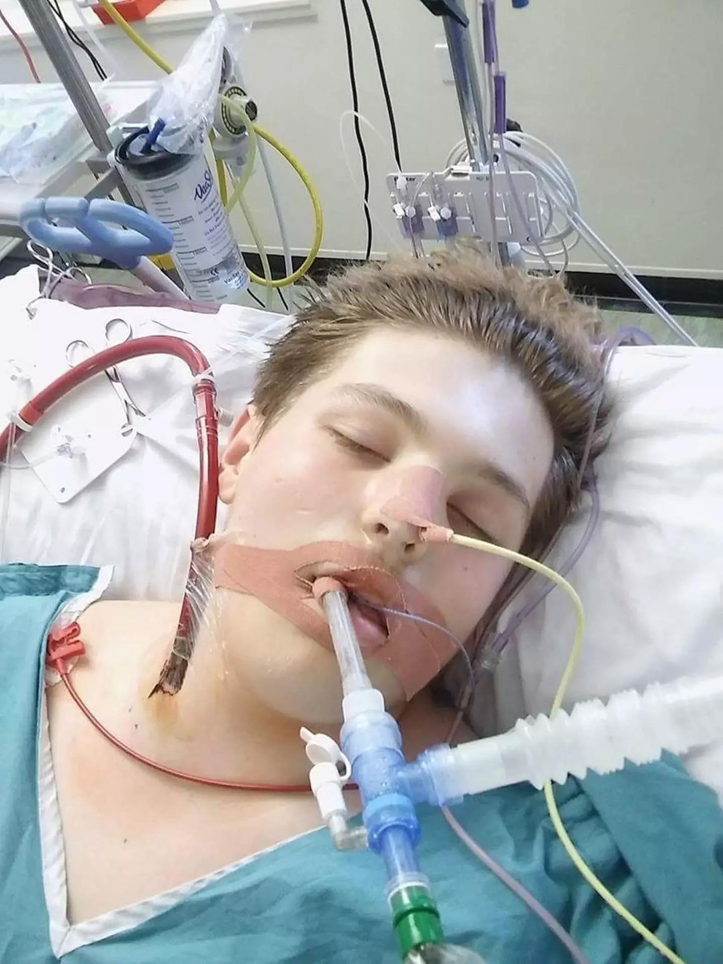 Ewan Fisher ended up in ICU due to his vaping habit.