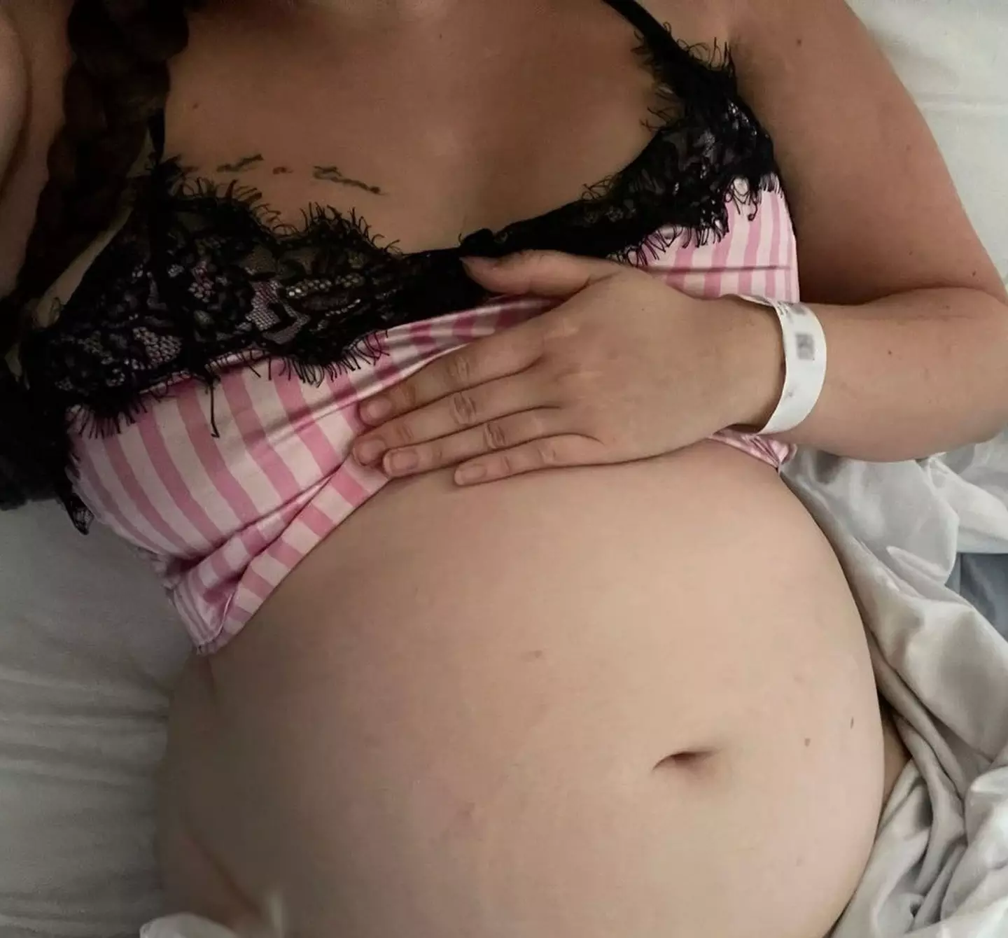 The 21-year-old's stomach swelled drastically after eight months of being unable to go to the toilet properly (Kennedy News and Media)