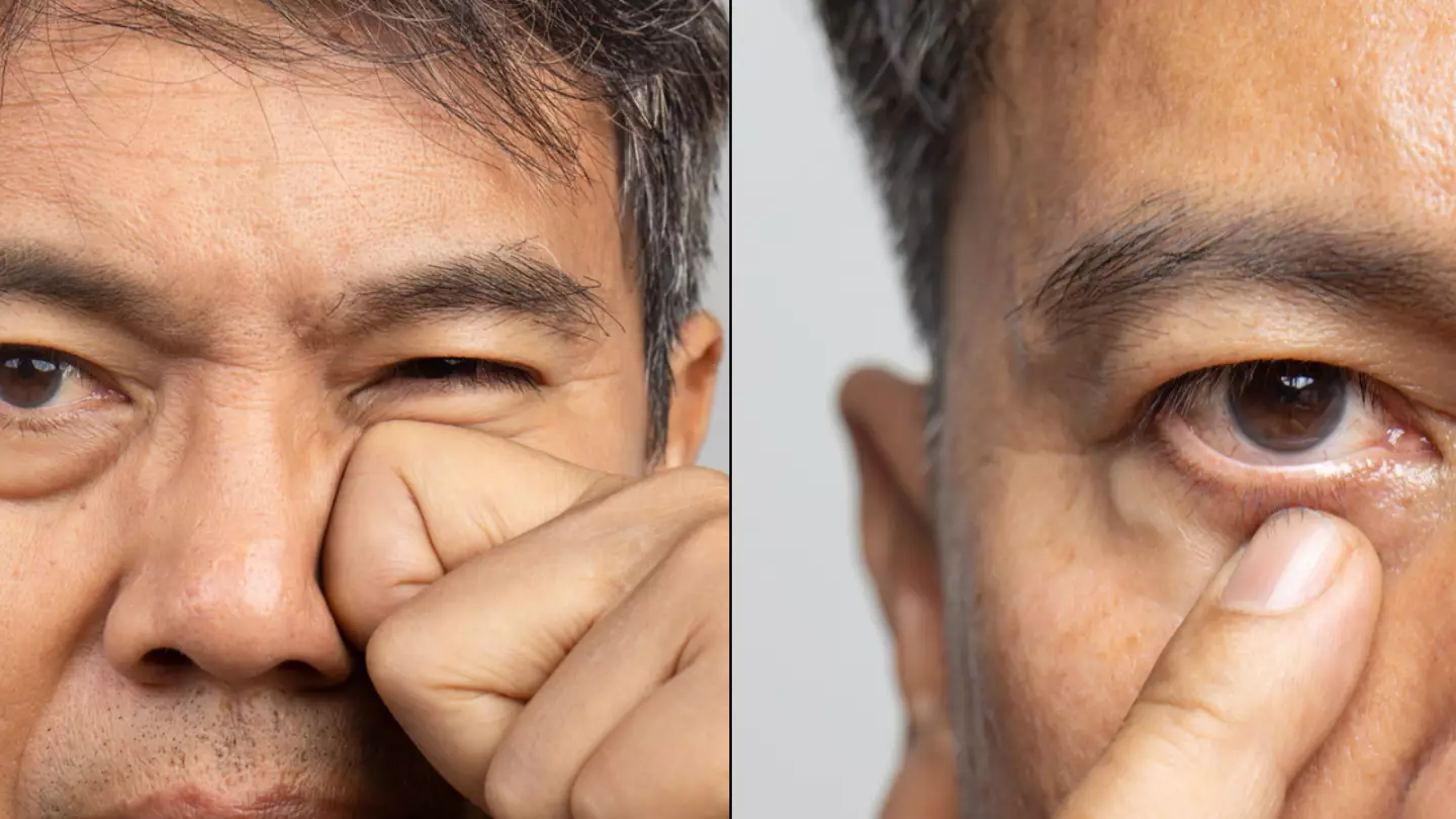 How to know when occasional 'twitch' in your eye could be something more dangerous