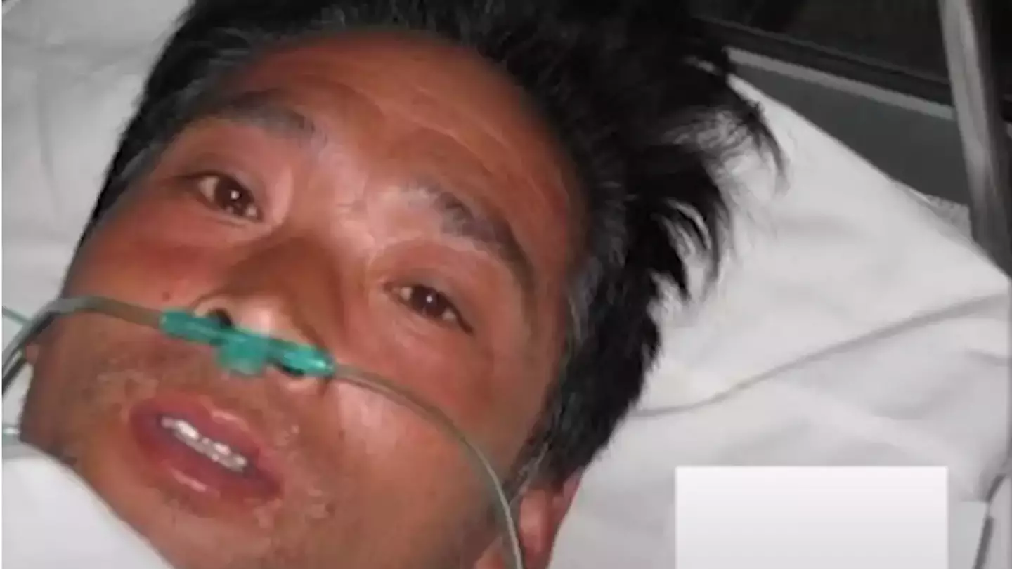 Horrific incident that led to man suffering 'most painful death ever' where he cried blood and was kept alive for 83 days