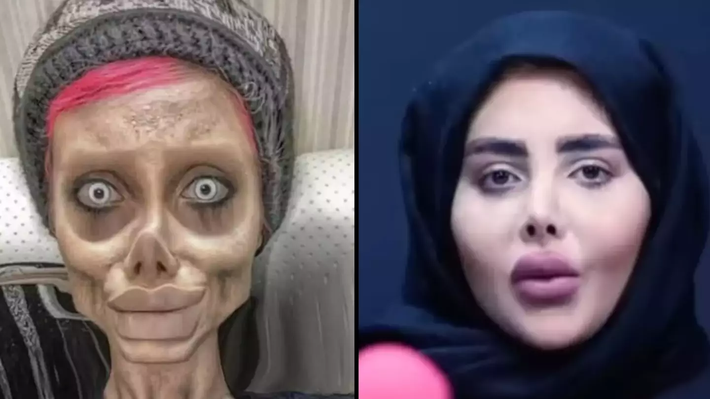 Woman went to extreme lengths to turn into 'zombie Angelina Jolie' before getting jailed