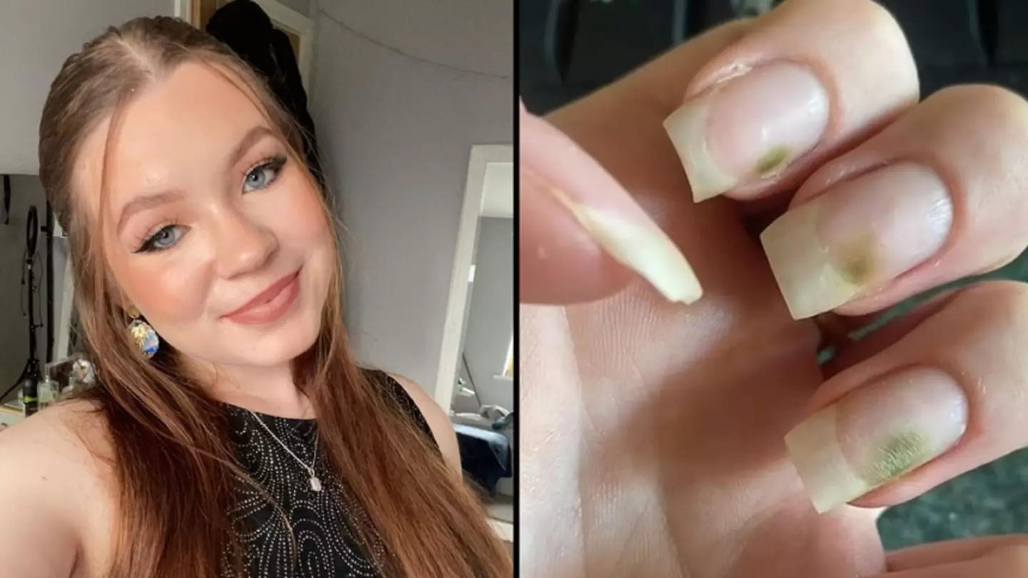 Student horrified as ‘mouldy fungus’ sprouts out of her finger nails after festive manicure
