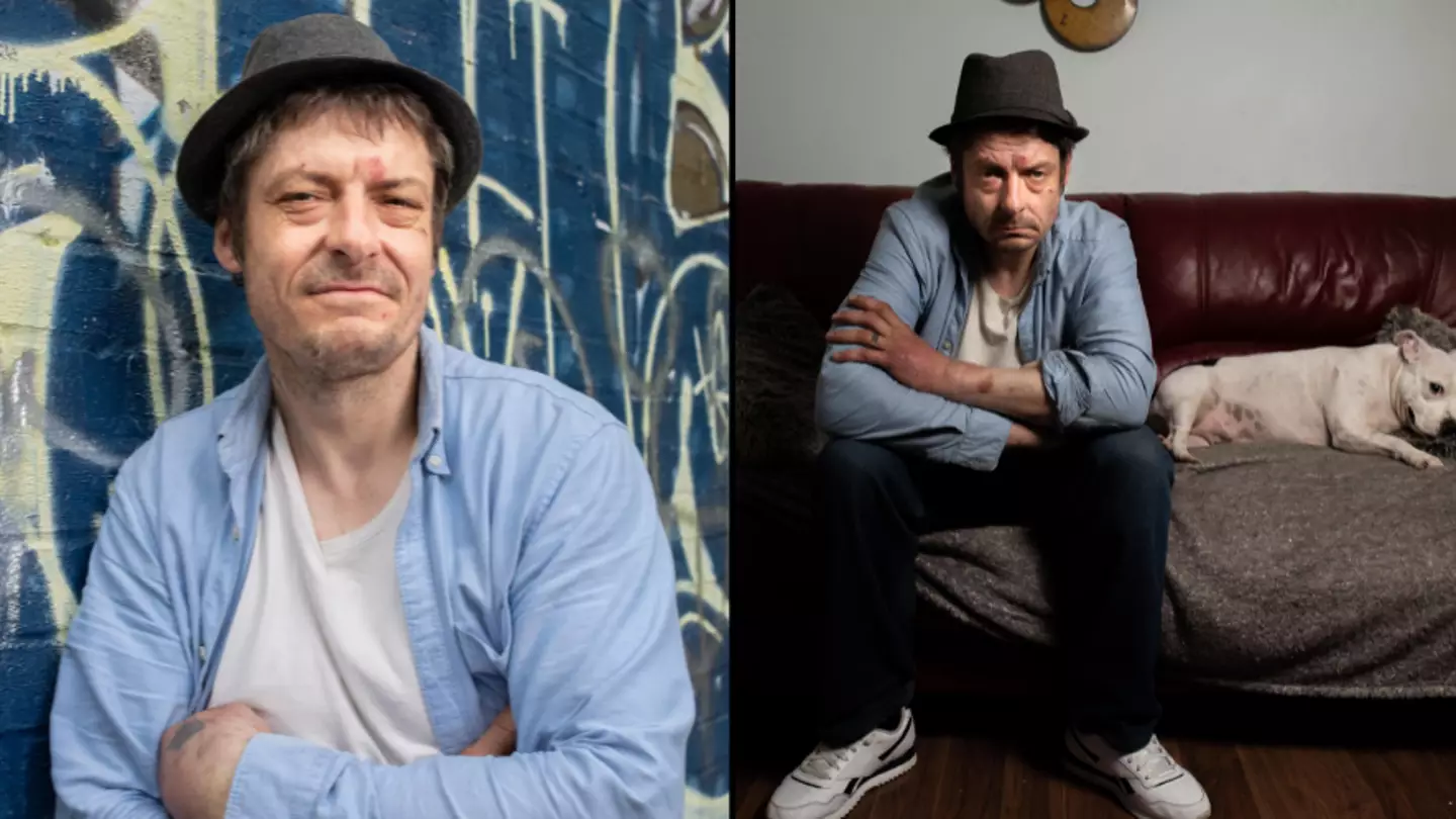 Viewers 'Speechless' Over Shocking Channel 4 Documentary About A Man With A Penis On His Arm