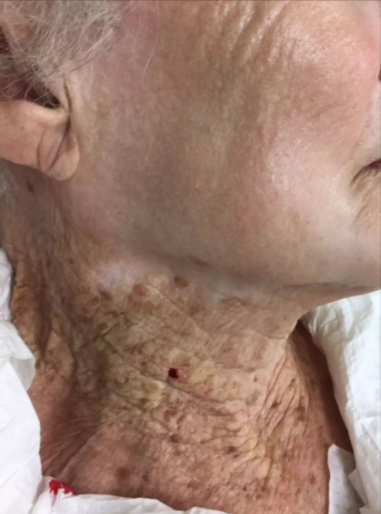 You can see the clear difference between the skin on her face and neck.