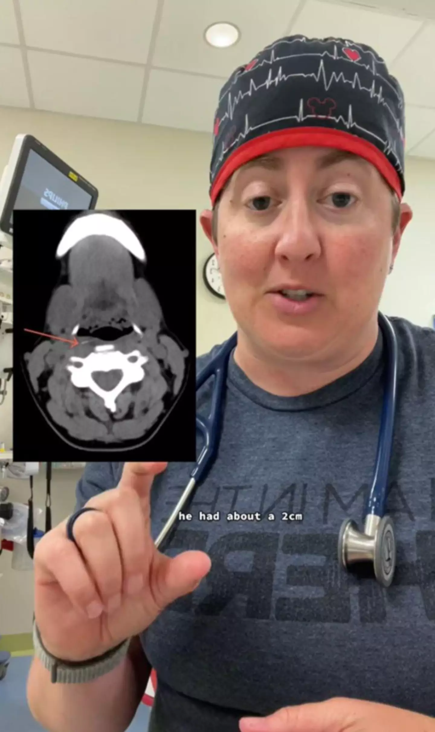 The CAT scan revealed something unbelievable.