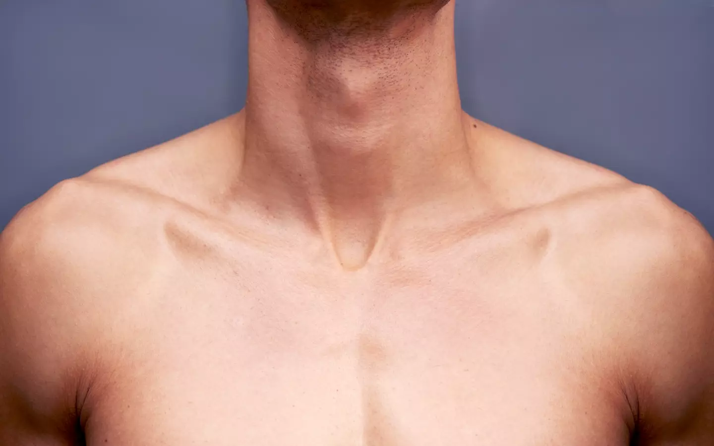 This is a neck, it connects your head to the rest of you, please look after it as you only have the one.