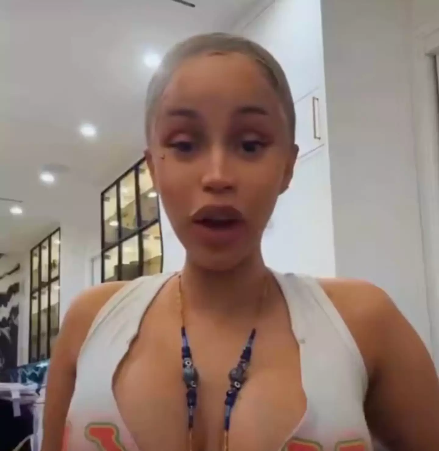 Cardi said 'roach and mosquito eggs' might be living in her scalp as she hasn't washed her hair in so long (Instagram/@iamcardib)