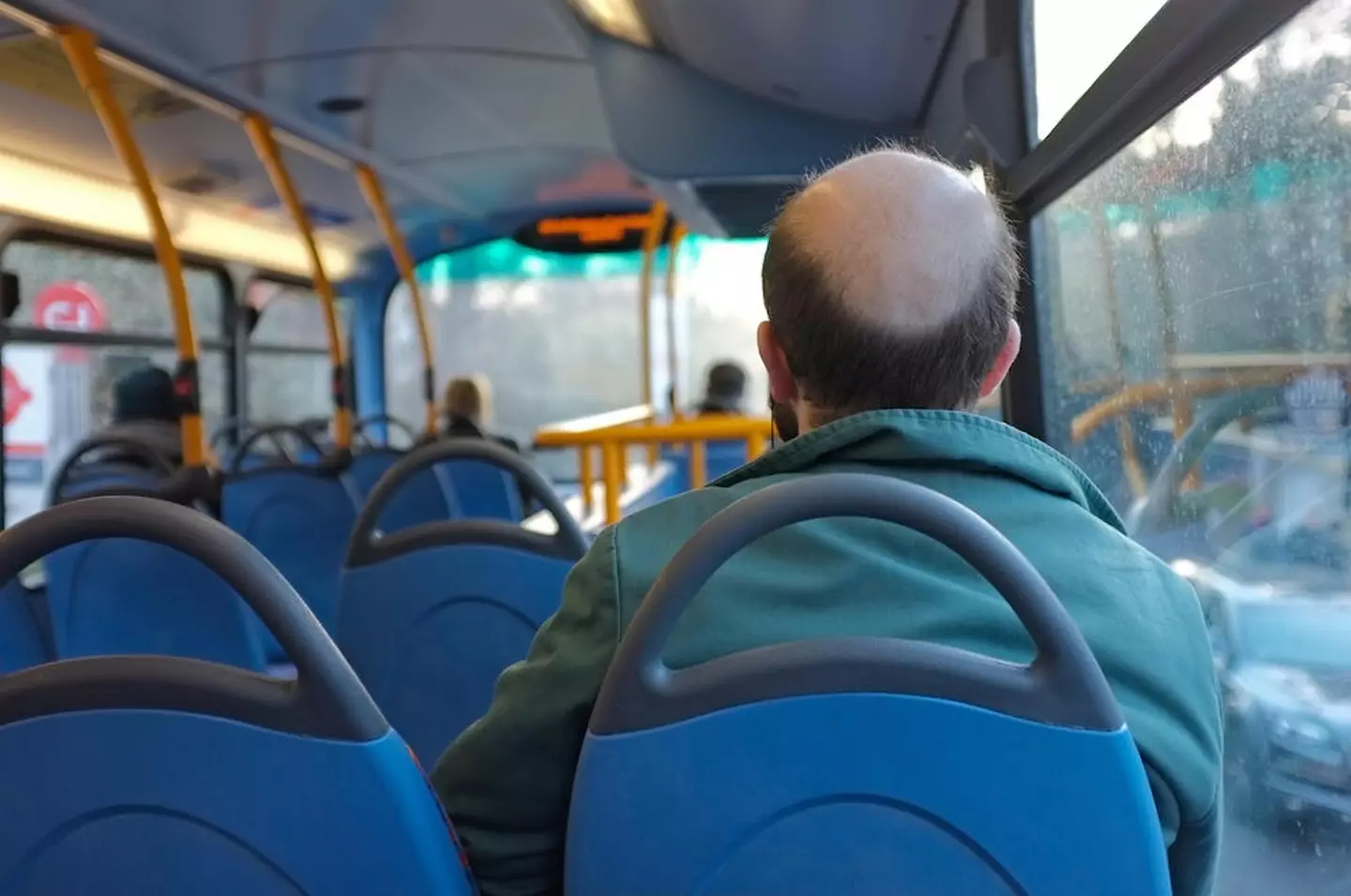 Baldness impacts millions of people worldwide.