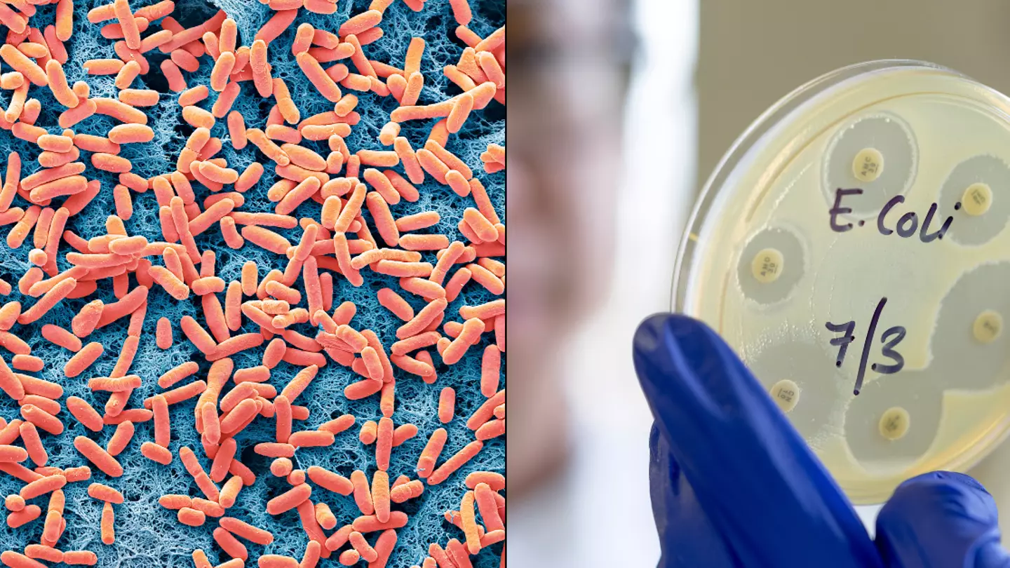 Government issue advice on how to avoid E-coli following rise in cases in UK