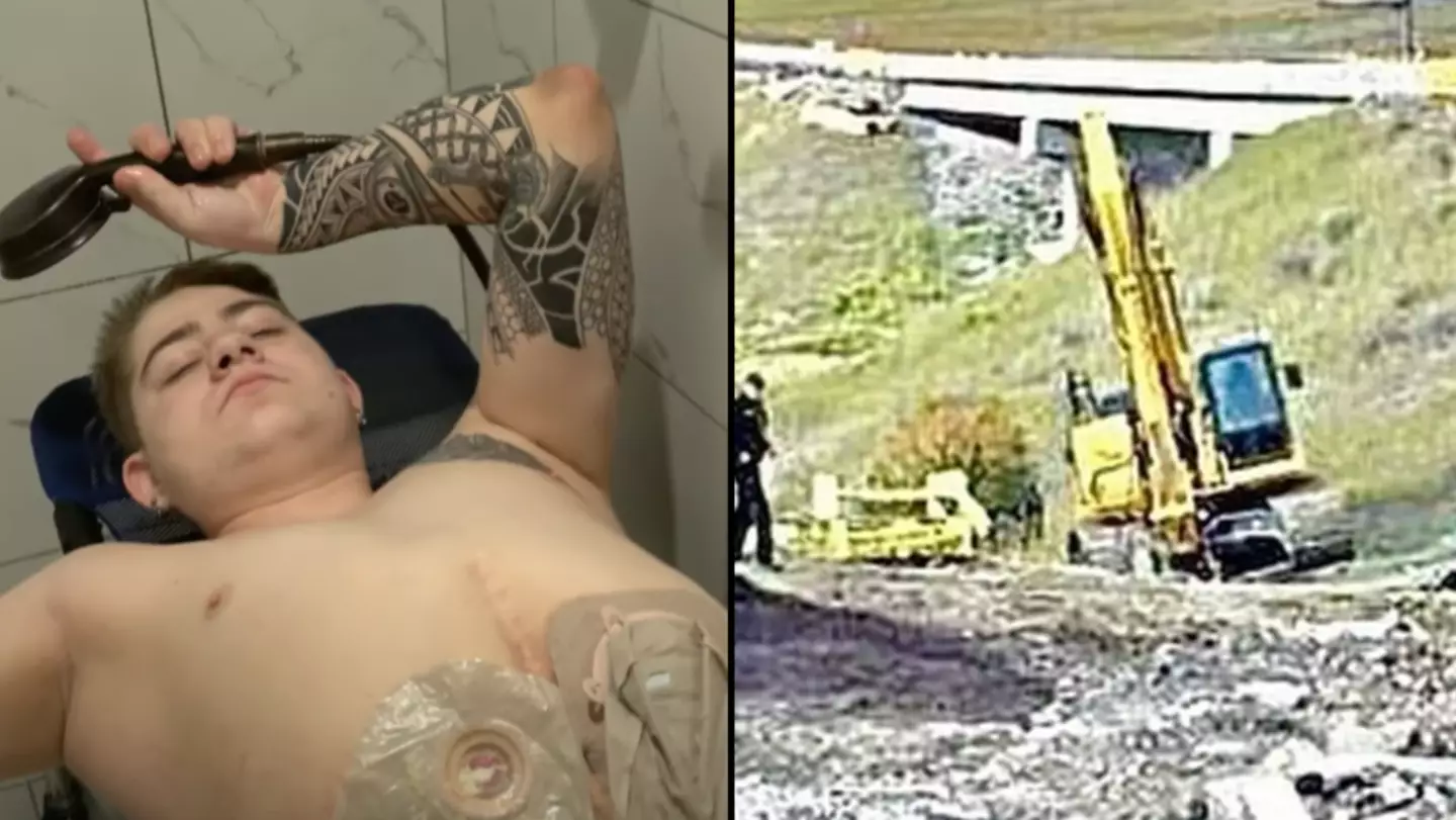 Man cut in half by forklift accident bravely shared a horrifying photo from the scene