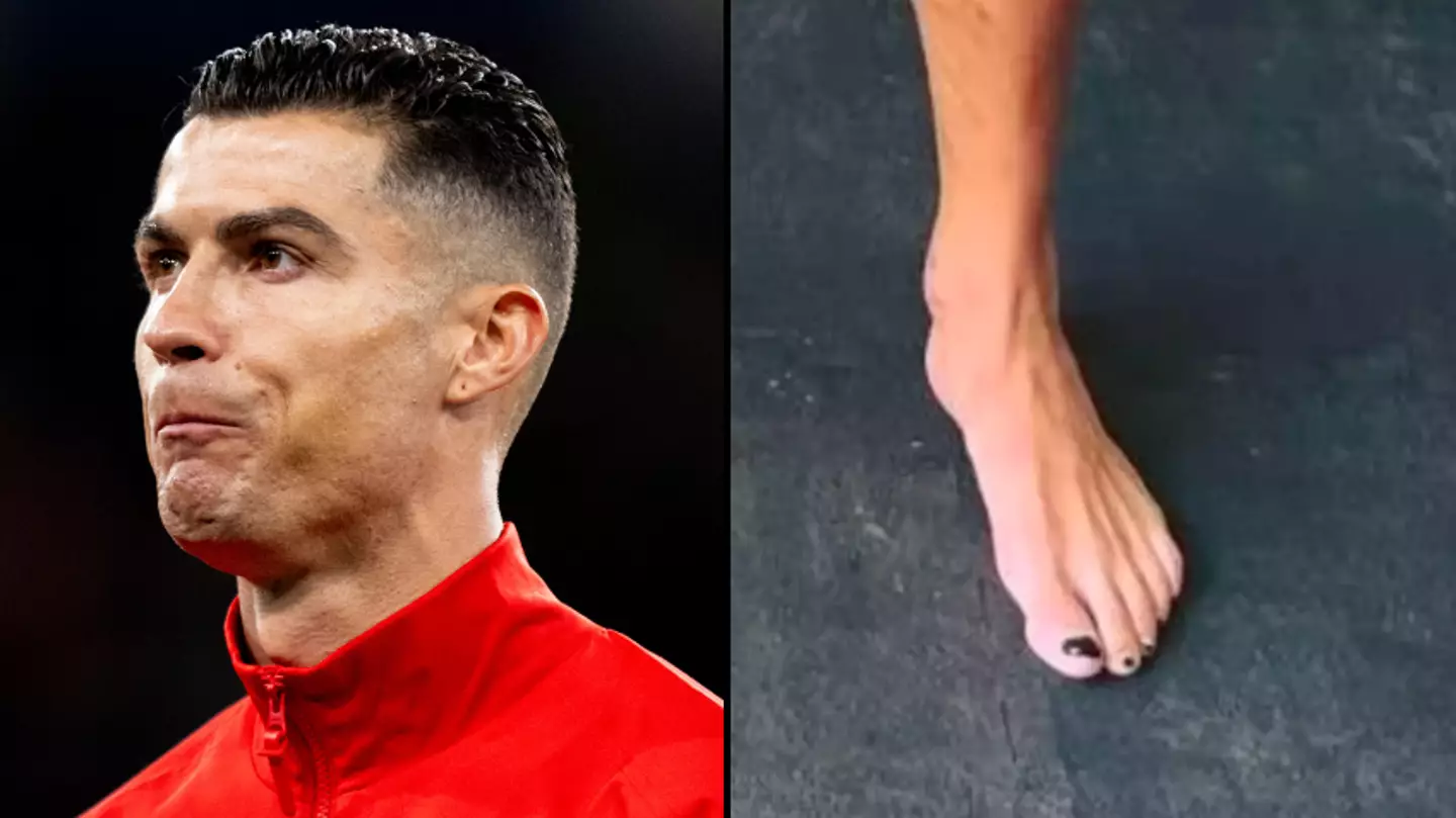 Reason Cristiano Ronaldo always paints toenails black and you may see it during Euros