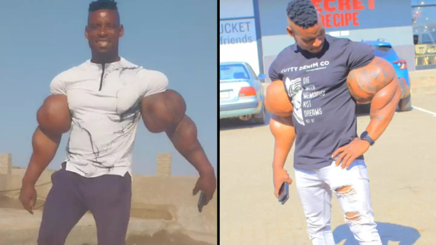 Man with incredibly large biceps leaves people absolutely shocked
