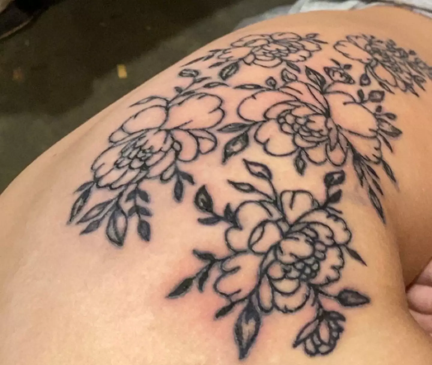 Medics informed Samantha the £150 design left her with cellulitis (Kennedy News and Media)