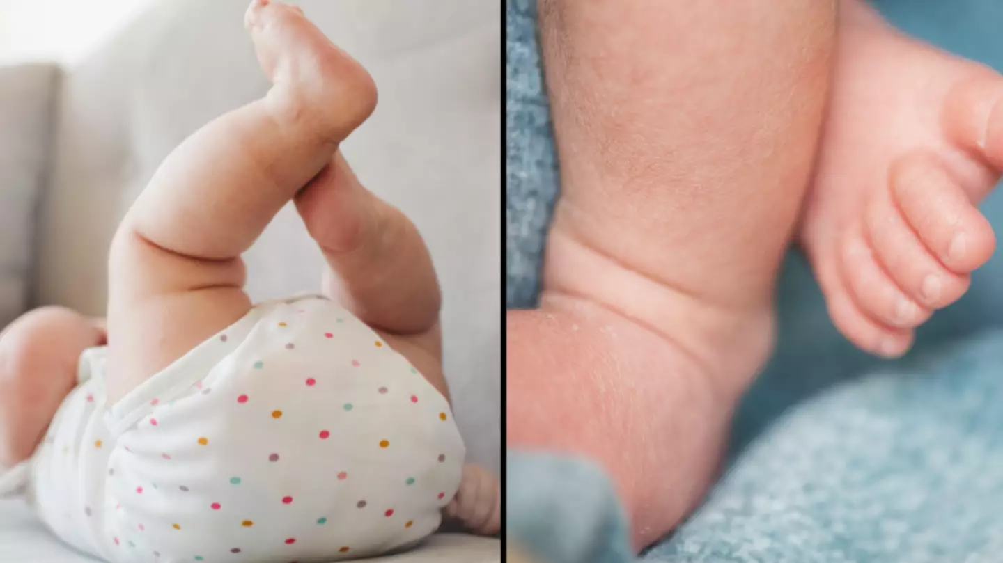 Baby born with two working penises but no anus in bizarre medical case