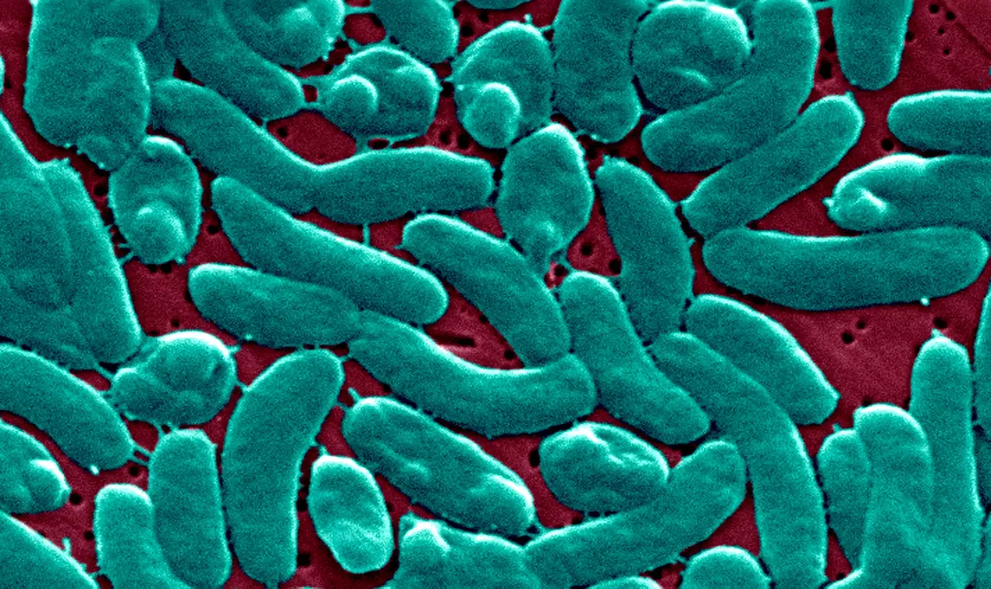 Vibrio vulnificus can also impact those who have eaten contaminated seafood (BSIP/UIG Via Getty Images)