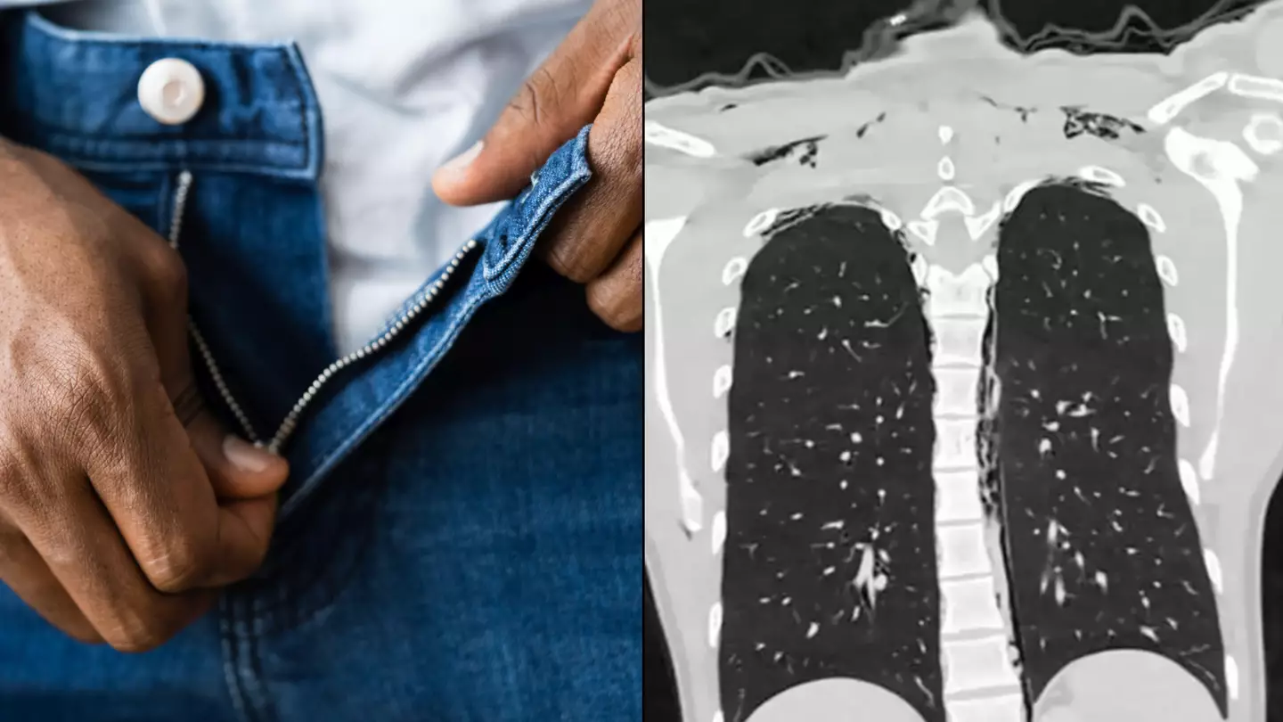 Man Rushed To Hospital After Suffering Horrific Injury From Overly Aggressive Masturbation