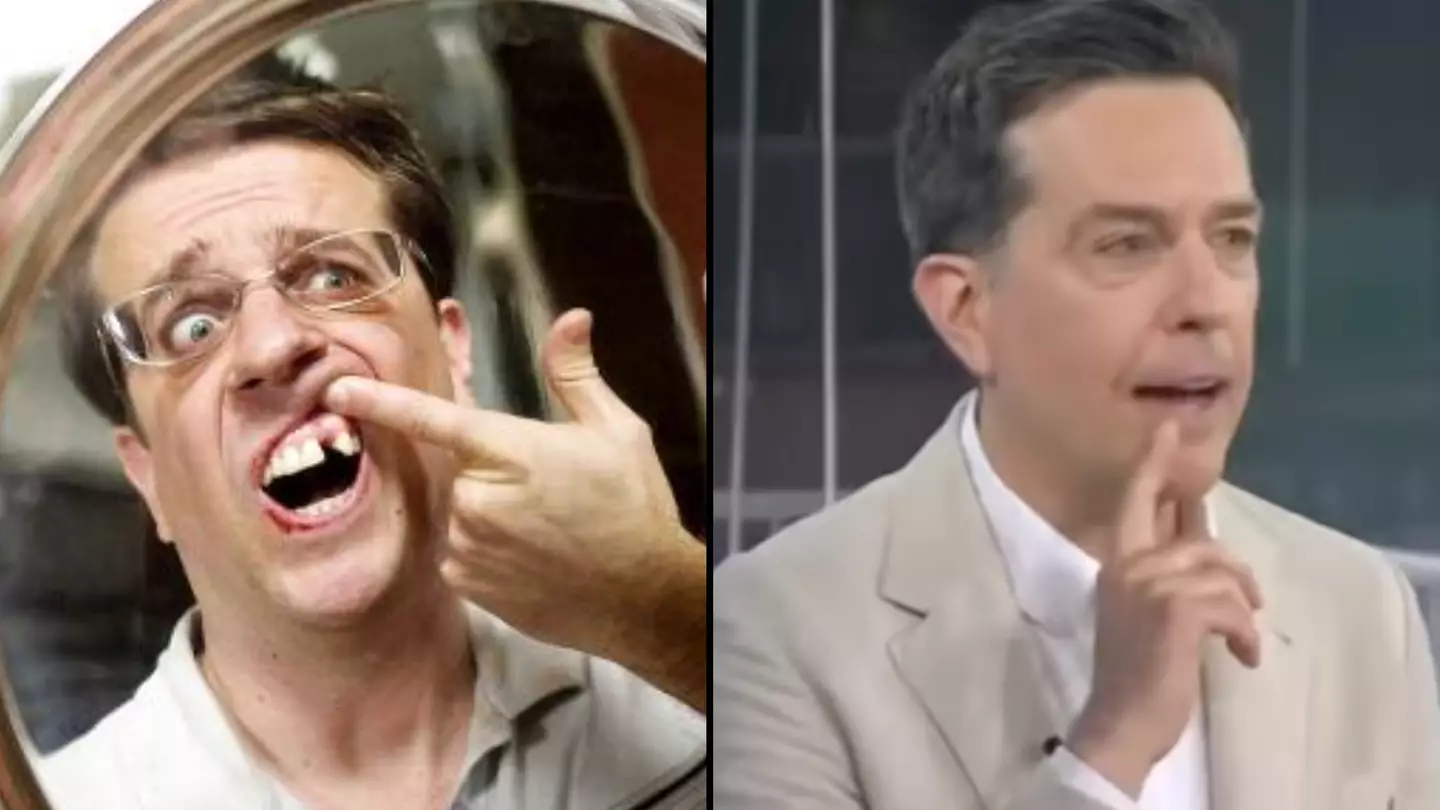 Ed Helms removed his actual tooth for role in The Hangover