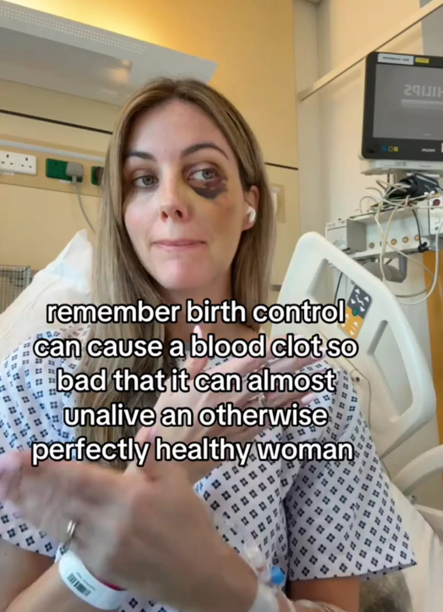 Emily revealed the visible bruises she sustained from collapsing due to the blood clot in a follow-up vide (TikTok/@alwayssingingmom)