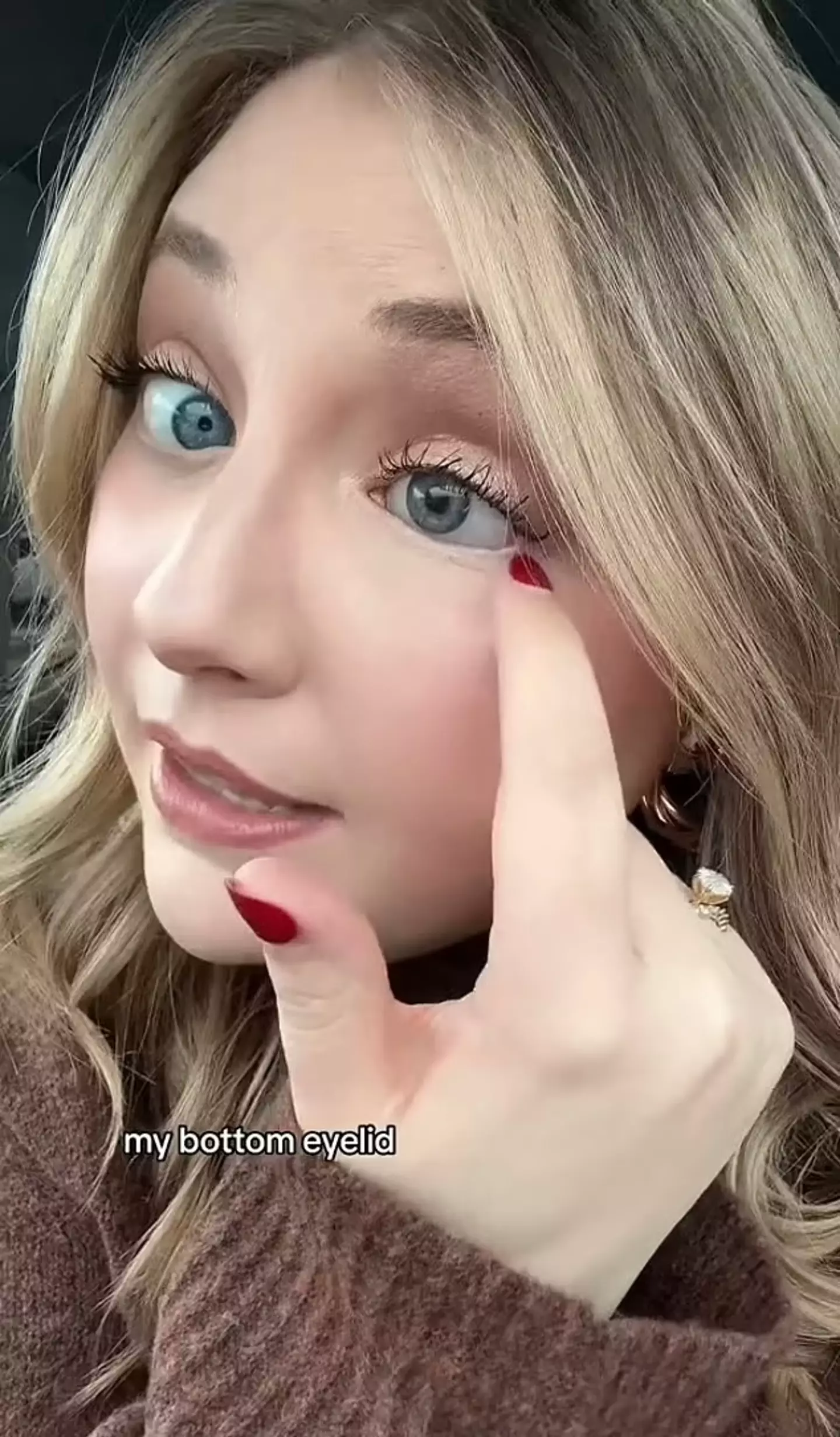 She explained that her sunglasses shattered on impact and 'shredded' her eye.