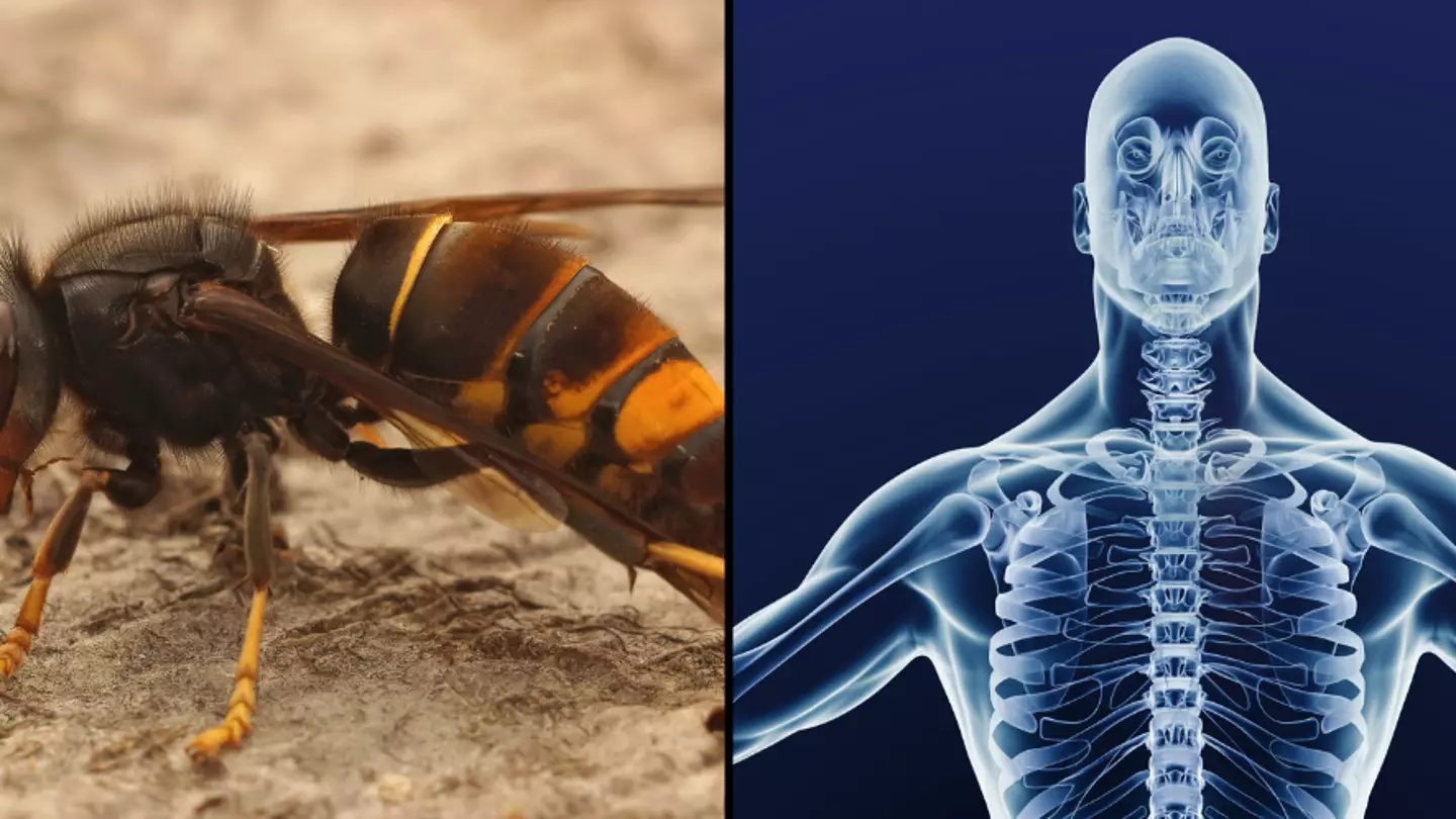 Step by step of what happens to your body if you get stung by ‘dangerous’ Asian Hornet