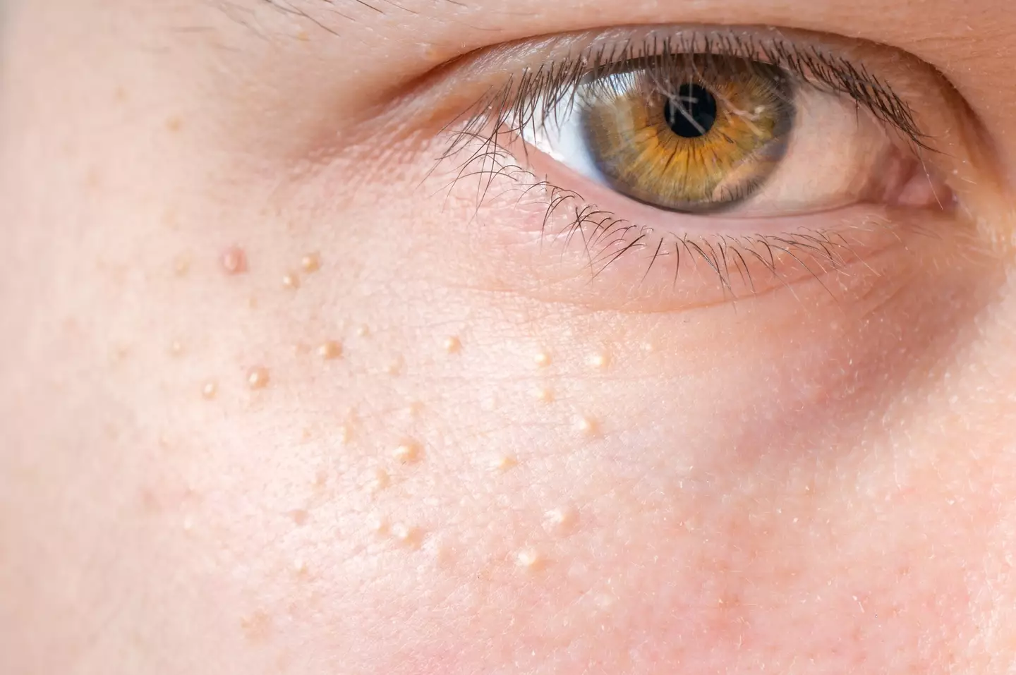 The strange white spots are thankfully nothing to worry about (Getty Stock Image)
