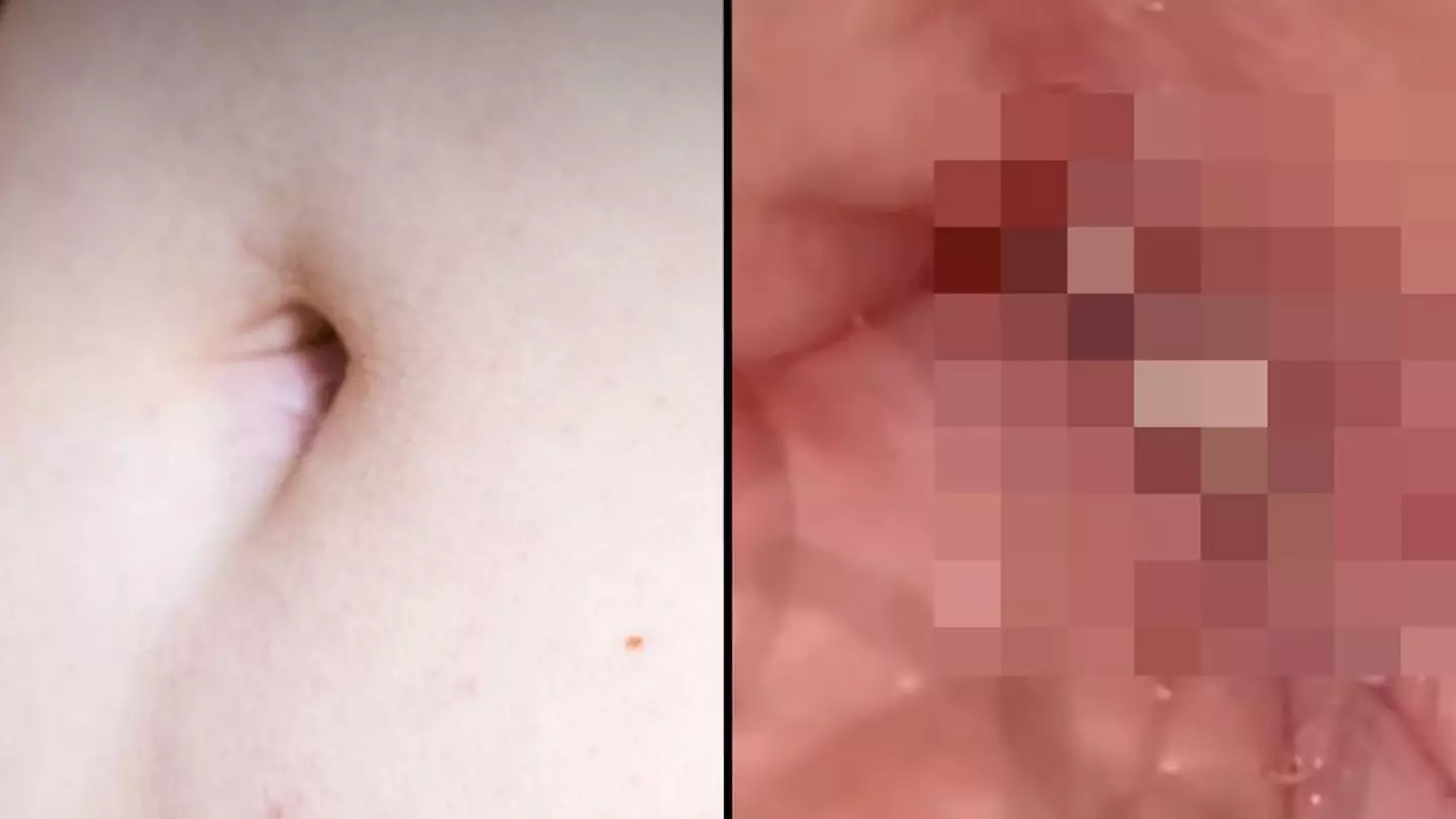 Grim reality of what happens when you don't wash your belly button