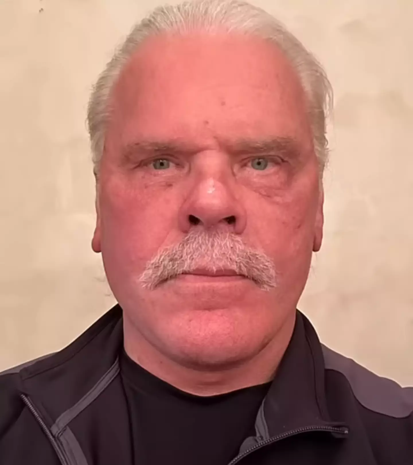 This is what the man looks like after his surgery (YouTube/DrKassir)