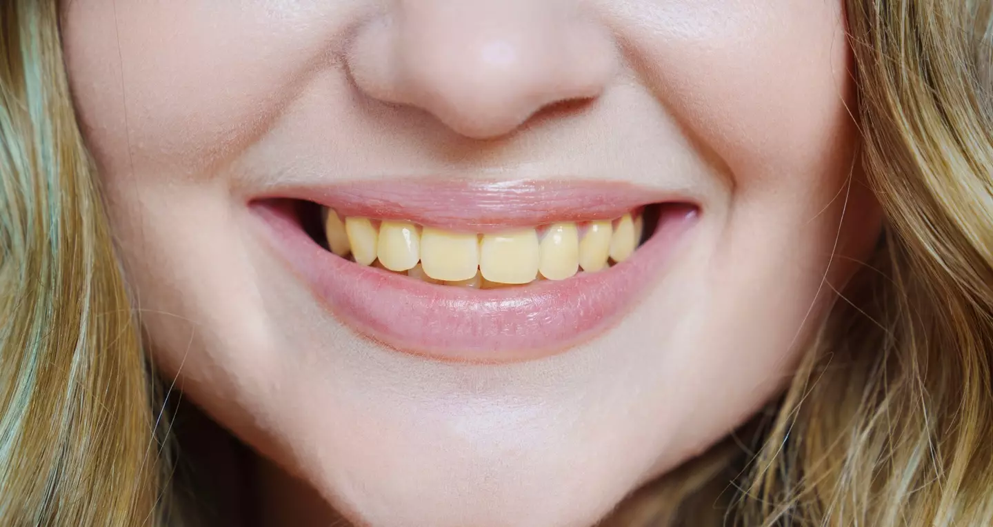The dentist explained why you might have yellow teeth despite taking good care of them (Getty Stock Image)