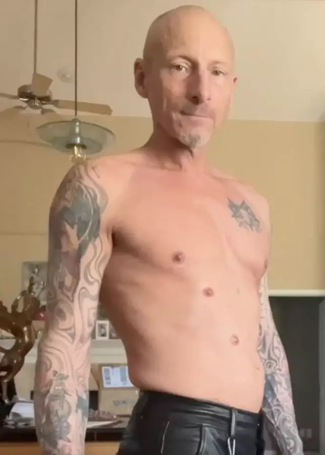 Harry's six nipples. (Jam Press)