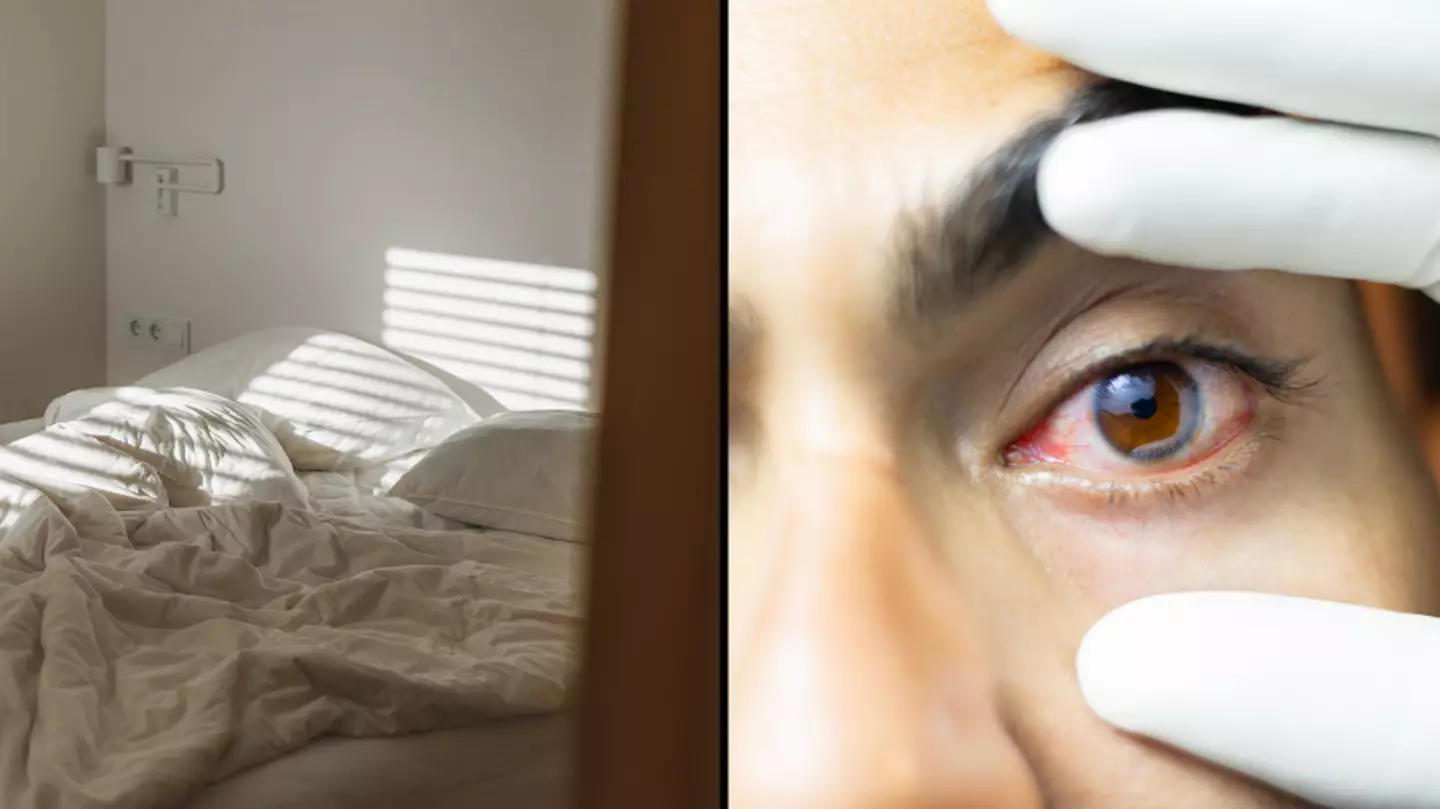 Truth behind people thinking farting on a pillow can cause someone 'pink eye'