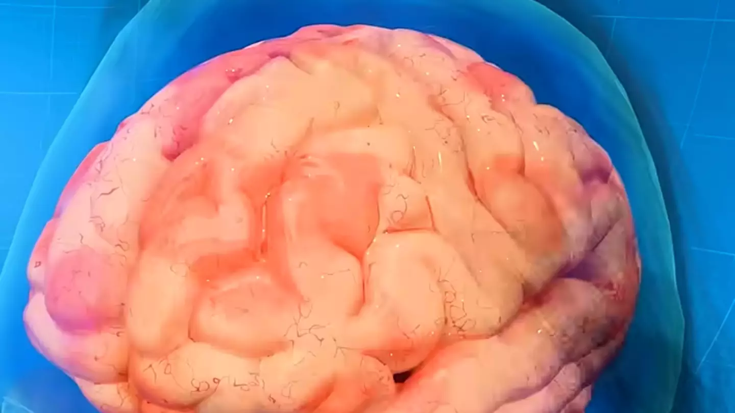 Doctor shares worrying effects alcohol has on brain as simulation shows terrifying reality