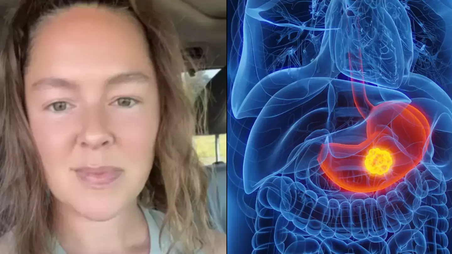 One takeaway cancer dietician warns people to avoid as doctor blames one thing for 'every new patient' being under 40