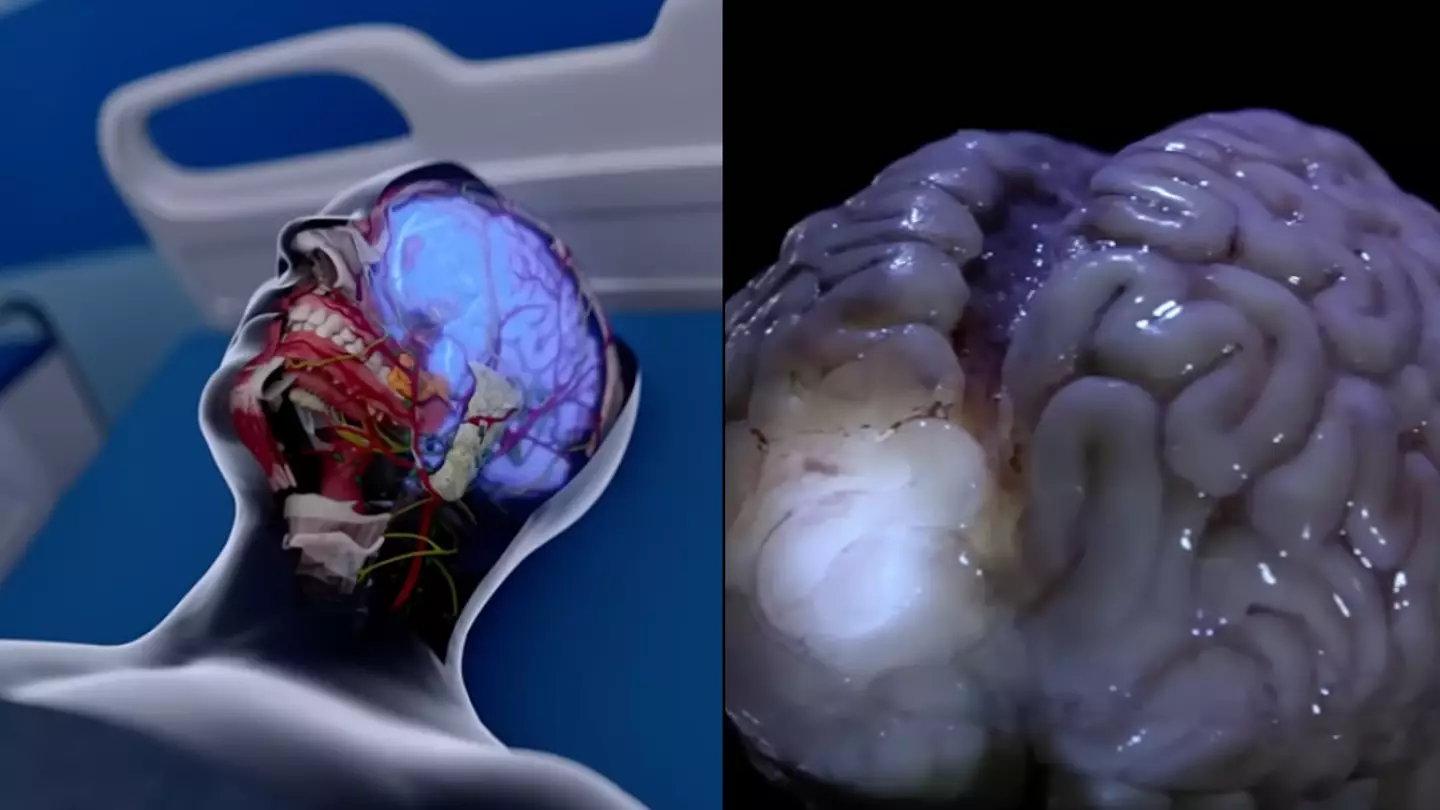 Realistic simulation shows what happens to our brains within 10 minutes of someone dying