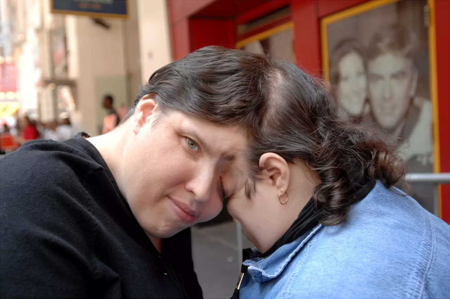 Lori and George Schappell were conjoined their whole lives. (Susan Watts/NY Daily News Archive via Getty Images)