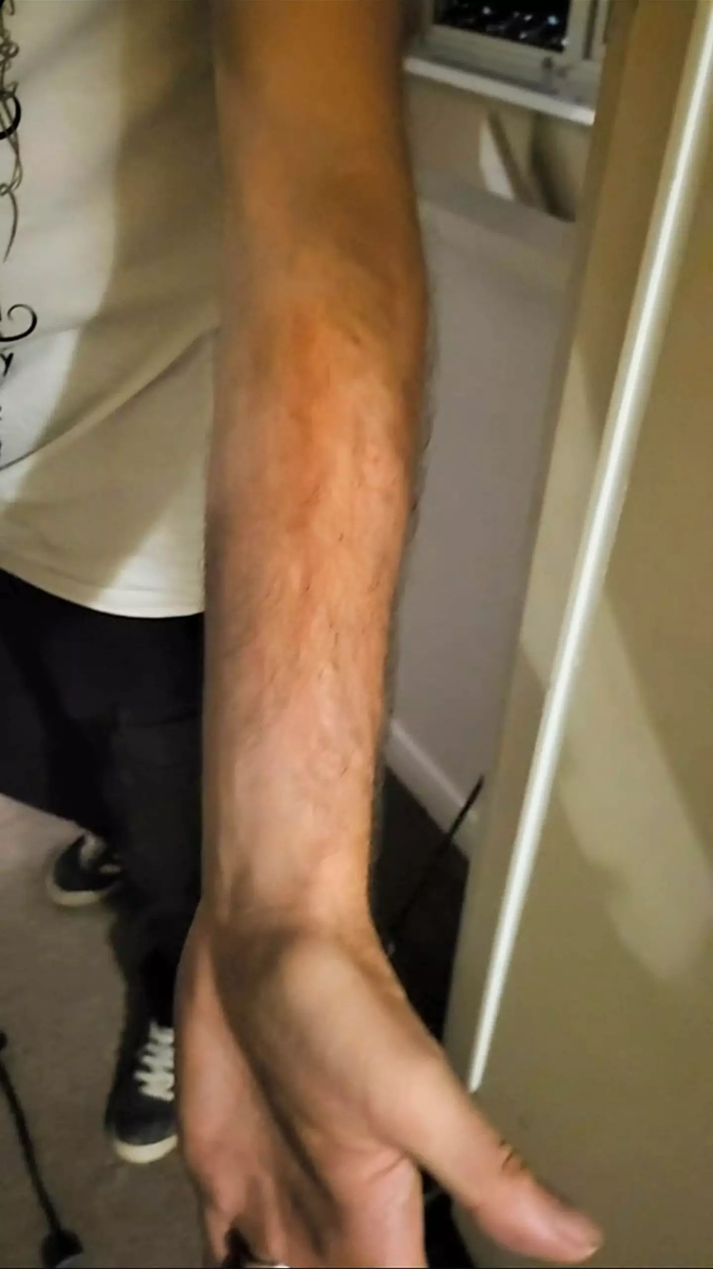 There were about four scratches in total.