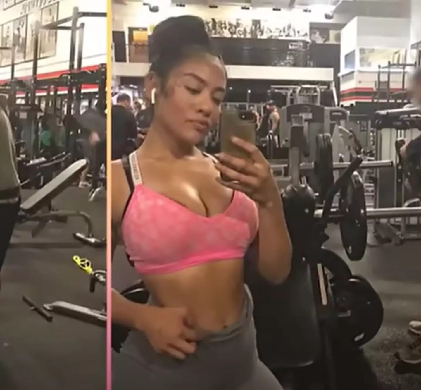 What Leslie looked like before surgery (YouTube/truly)