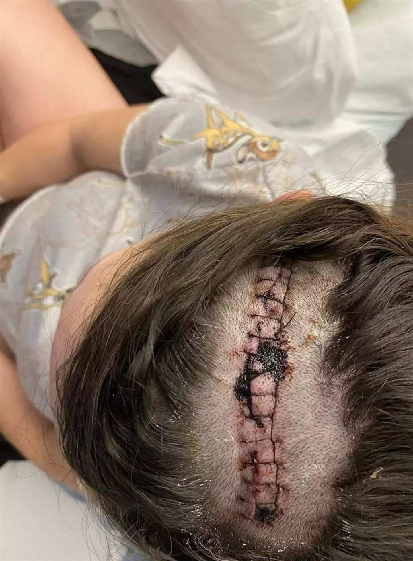 The mum-of-four was informed she had a brain tumour while 35 weeks pregnant (SWNS)