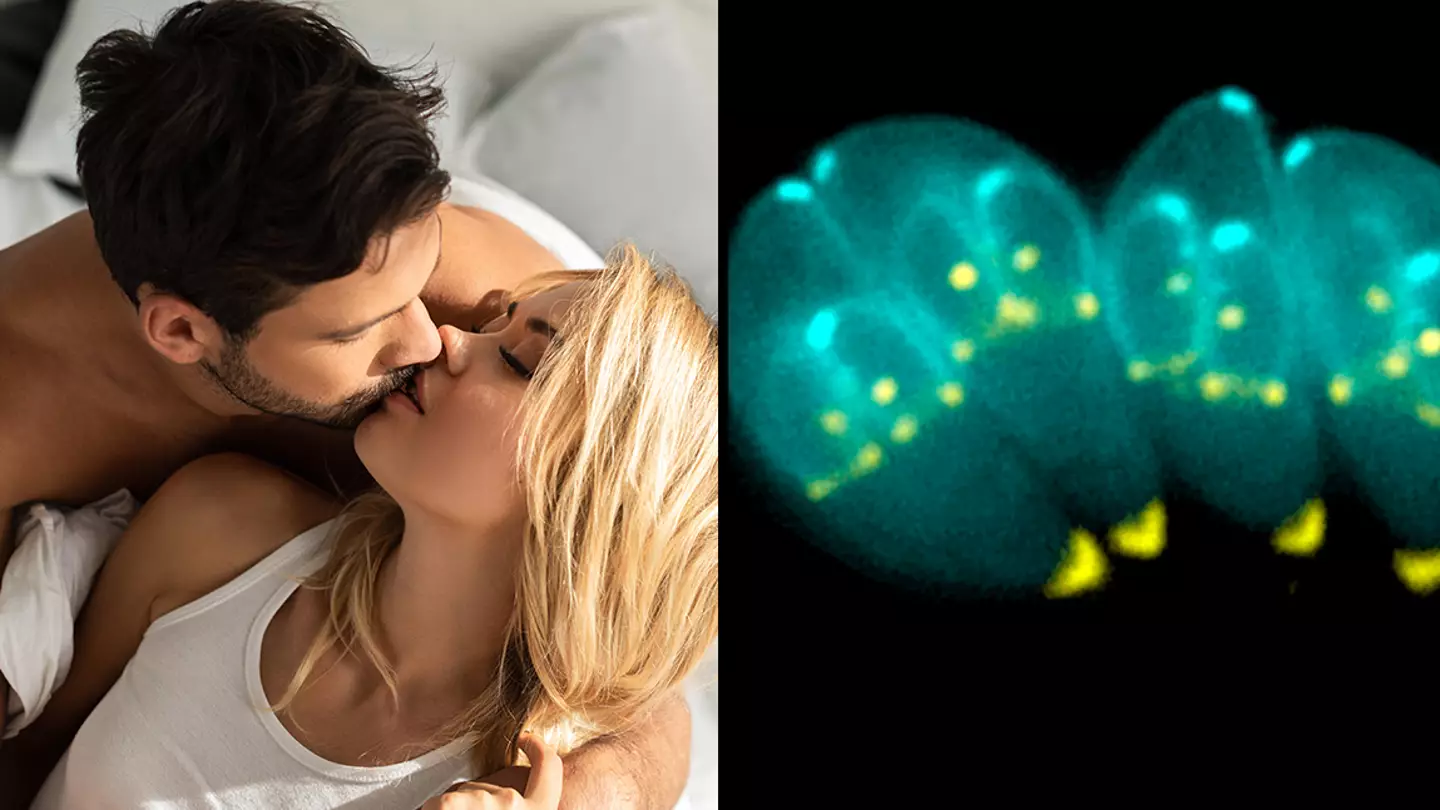 Parasite makes you more attractive so you have more sex and spread it, according to study