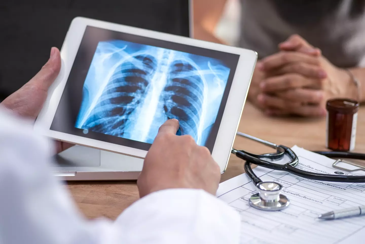 Catching lung cancer early is vital in increasing the chances of survival. (Getty Stock Image)