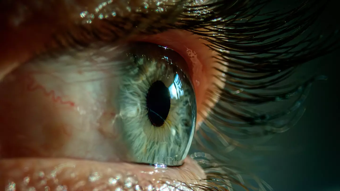 Expert reveals what you should do if you start seeing 'floaters' in your eyes