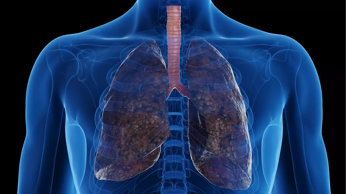 All 'red flag' warning signs that suggest you have lung damage