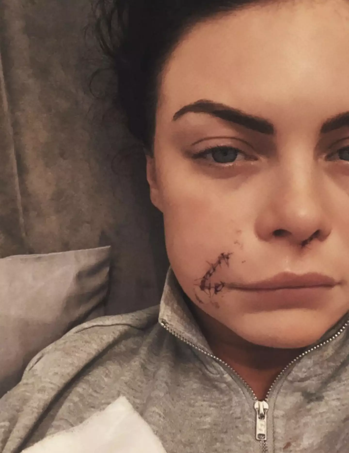 Kelsea's scars remain something she's 'ashamed' of.